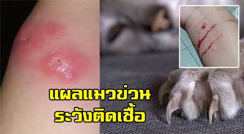 แพทย์เตือน !! ''แมวข่วน'' ให้รีบไปรักษา-ฉีดยาป้องกัน อย่าชะล่าใจ เพราะอาจเกิดโรคแบคทีเรียติดเชื้อรุนแรง !!!
