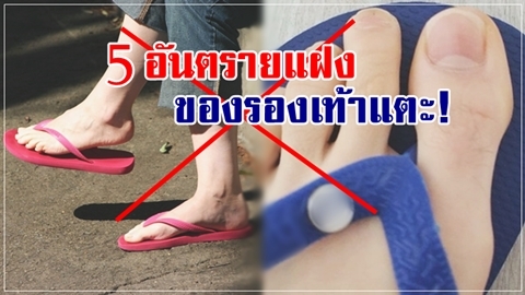 ใส่บ่อยต้องอ่านไว้!! 5 อันตรายแฝงของ 'รองเท้าแตะ' ที่คุณควรรู้อย่างแรง!!