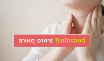 ไทรอยด์ เกิดจากสาเหตุใด มีวิธีรักษายังไง