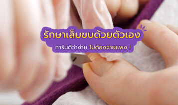 รักษาเล็บขบด้วยตัวเอง ได้ง่ายๆ ไม่ต้องจ่ายแพง !