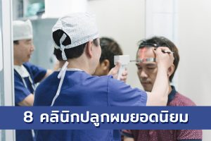 8 คลินิกปลูกผม 2024 ยอดนิยม จบปัญหาศีรษะล้าน ผมกลับมาหนาสวย