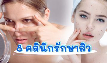 8 คลินิกรักษาสิว 2024 หมดปัญหาเรื่องสิว ราคาไม่แรง