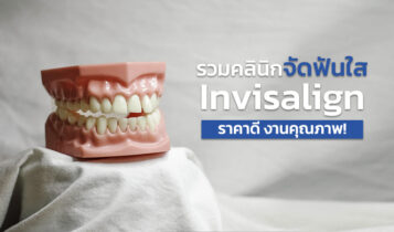 8 คลินิกจัดฟันใส Invisalign 2024 จัดฟันใส ที่ไหน ดี 2024 ราคาไม่แพง