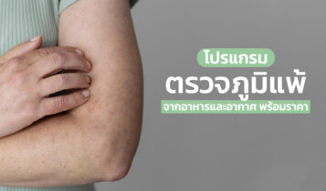รวมแพ็กเกจทดสอบภูมิแพ้ 2023 ตรวจภูมิแพ้ที่ไหนดี พร้อมราคา