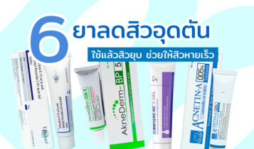 6 ยาลดสิวอุดตัน ครีมลดสิวอุดตันไม่มีหัว ใช้แล้วสิวยุบ ช่วยให้สิวหายเร็ว