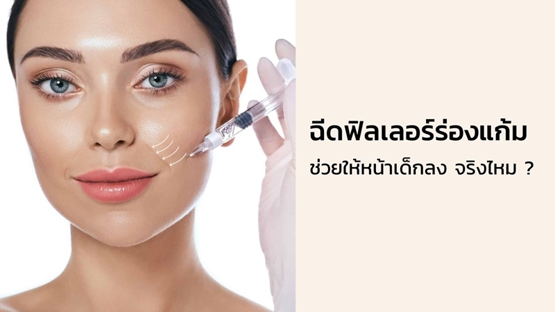 ฉีดฟิลเลอร์ร่องแก้ม