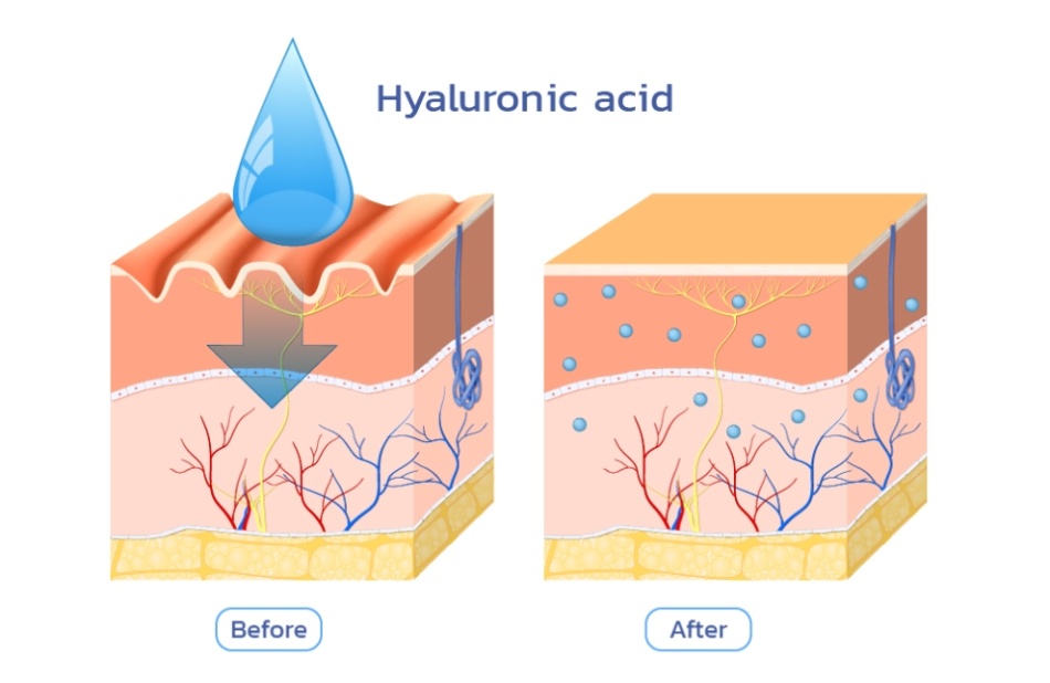 Hyaluronic acid