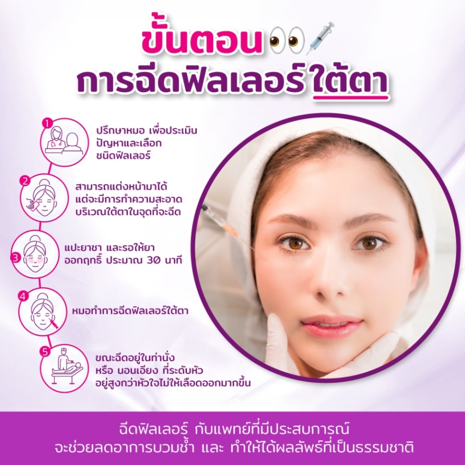 ขั้นตอนการฉีดฟิลเลอร์ใต้ตา
