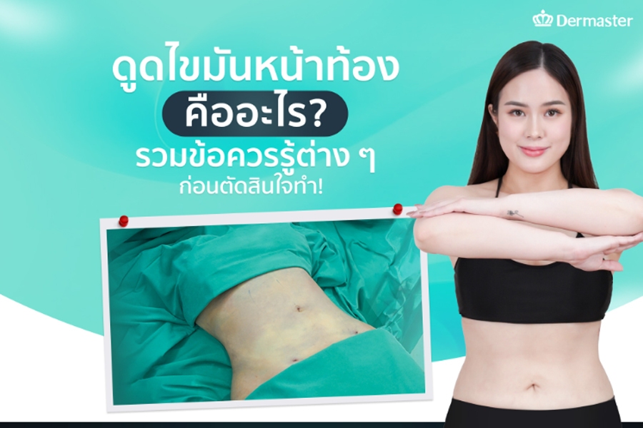 ดูดไขมันหน้าท้อง