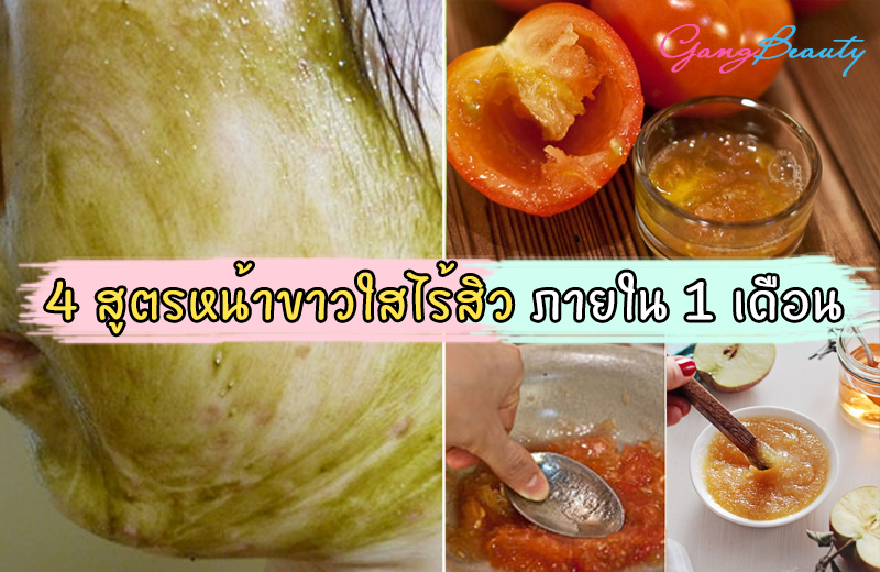 หน้าใสไร้สิว 7-11