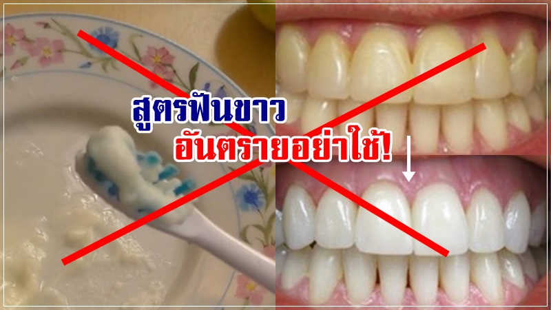 วิธี ทำให้ ฟัน ขาว