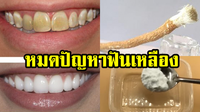 ทําให้ฟันขาว ในเซเว่น