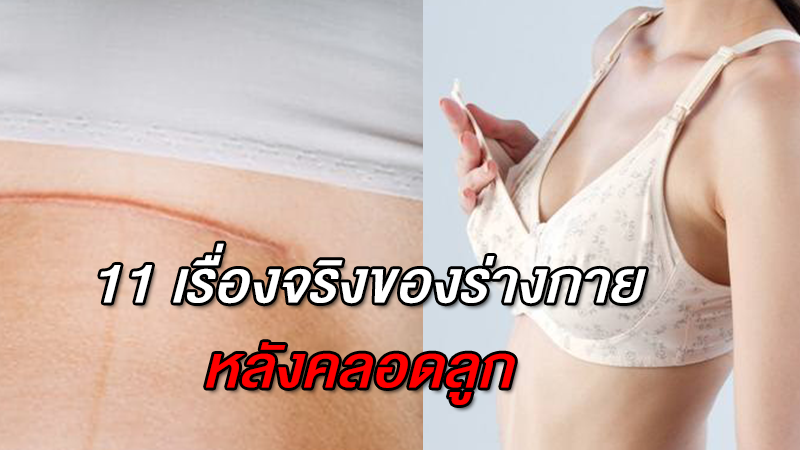 11 เรื่องจริงของร่างกาย หลังคลอดลูก  คนเป็นแม่หนีไม่พ้น