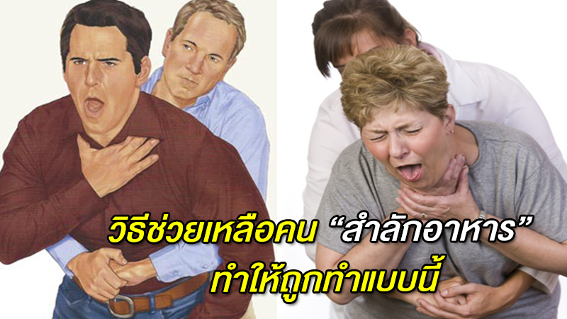 วิธีช่วยเหลือคน ''สำลักอาหาร'' ทำให้ถูกทำแบบนี้