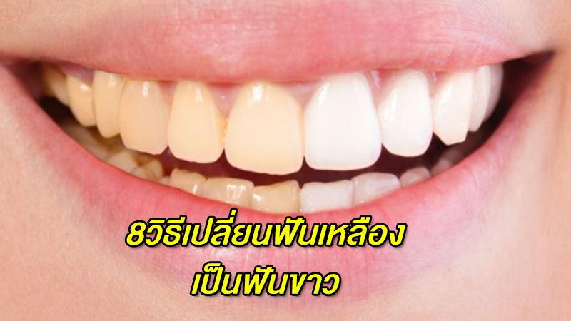 8 วิธีทำให้ฟันขาว แก้ปัญหาฟันเหลือง