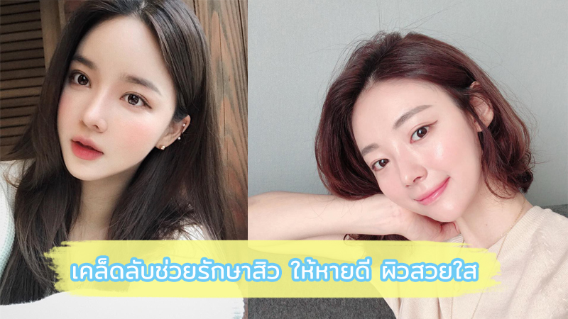 วิธีรักษาสิวบนผิวหน้า เพื่อผิวสวยใสอย่างตรงจุดและถูกวิธี