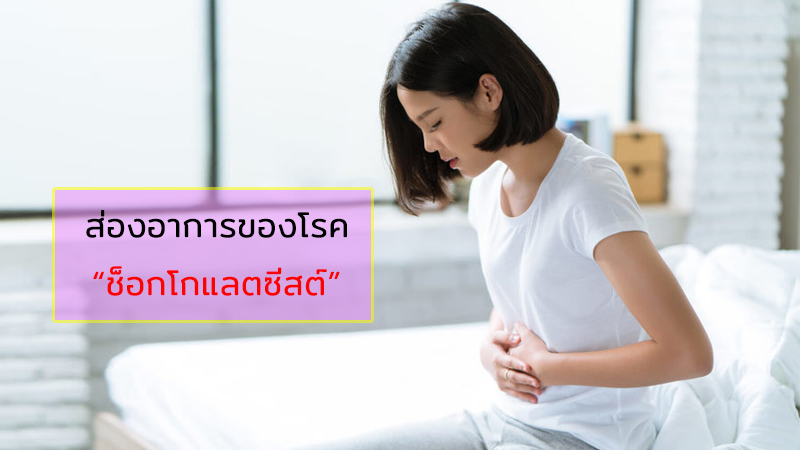 ส่องอาการของโรคช็อกโกแลตซีสต์ เป็นแล้วต้องรักษายังไง?